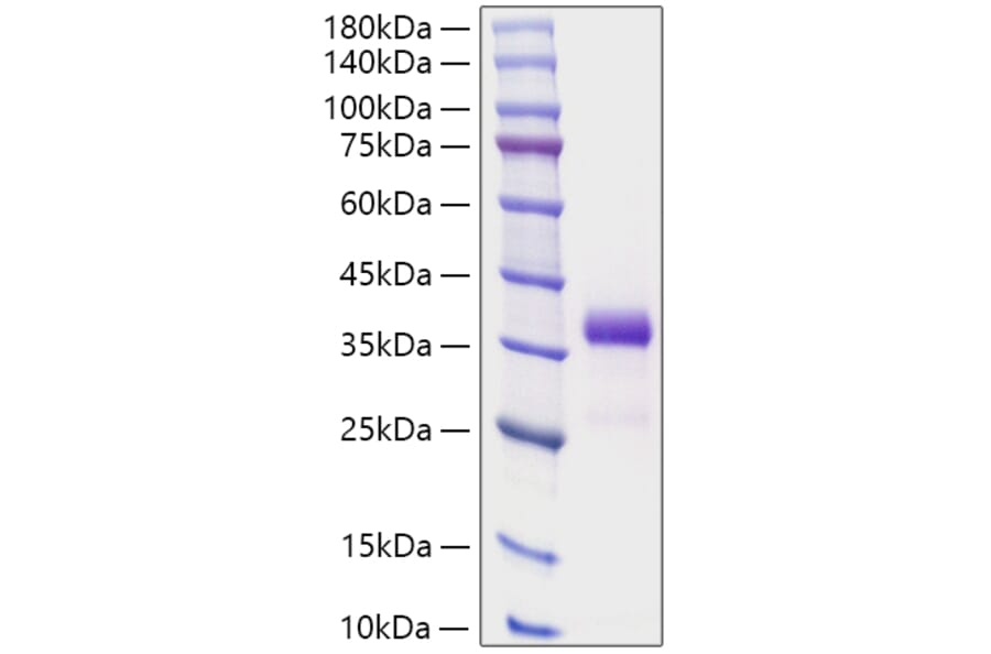 SDS-PAGE - Recombinant Human IGFBP7 Protein (N-terminal His Tag) (A330784) - Antibodies.com