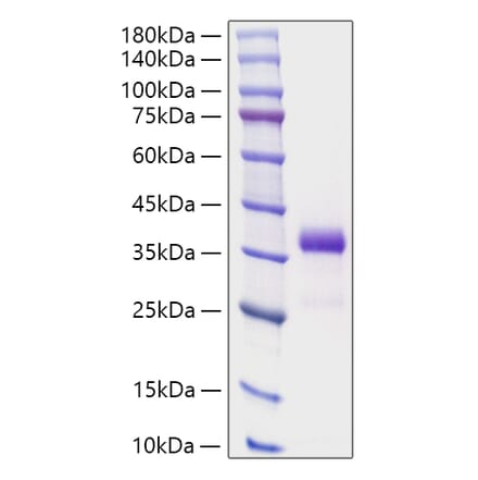 SDS-PAGE - Recombinant Human IGFBP7 Protein (N-terminal His Tag) (A330784) - Antibodies.com
