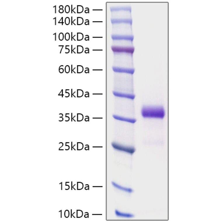 SDS-PAGE - Recombinant Human IGFBP7 Protein (N-terminal His Tag) (A330784) - Antibodies.com