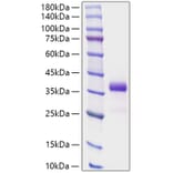 SDS-PAGE - Recombinant Human IGFBP7 Protein (N-terminal His Tag) (A330784) - Antibodies.com