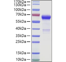 SDS-PAGE - Recombinant Human IGSF11 Protein (C-terminal Human Fc and Avi Tag) (A330787) - Antibodies.com