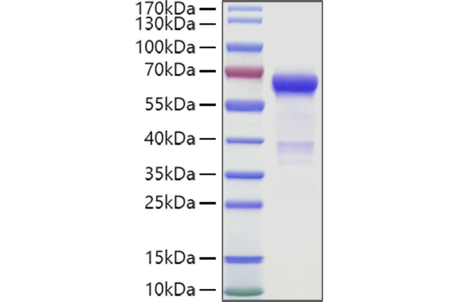 SDS-PAGE - Recombinant Human IGSF11 Protein (C-terminal Human Fc and Avi Tag) (A330787) - Antibodies.com