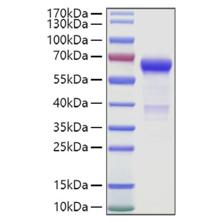 SDS-PAGE - Recombinant Human IGSF11 Protein (C-terminal Human Fc and Avi Tag) (A330787) - Antibodies.com