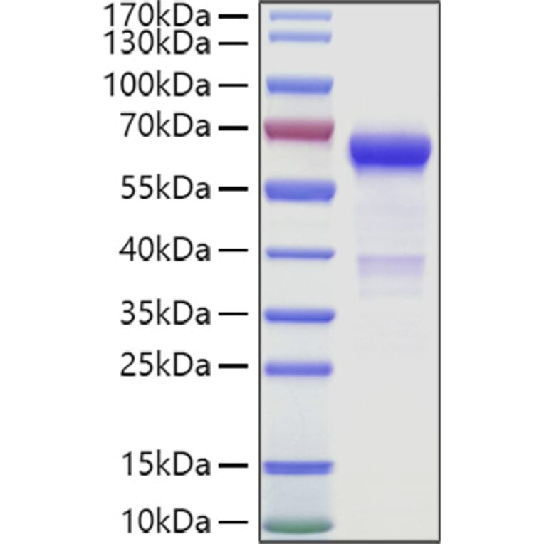 SDS-PAGE - Recombinant Human IGSF11 Protein (C-terminal Human Fc and Avi Tag) (A330787) - Antibodies.com
