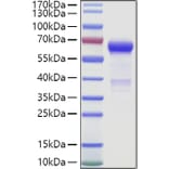 SDS-PAGE - Recombinant Human IGSF11 Protein (C-terminal Human Fc and Avi Tag) (A330787) - Antibodies.com