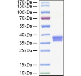 SDS-PAGE - Recombinant Human IGSF11 Protein (C-terminal His Tag) (A330788) - Antibodies.com