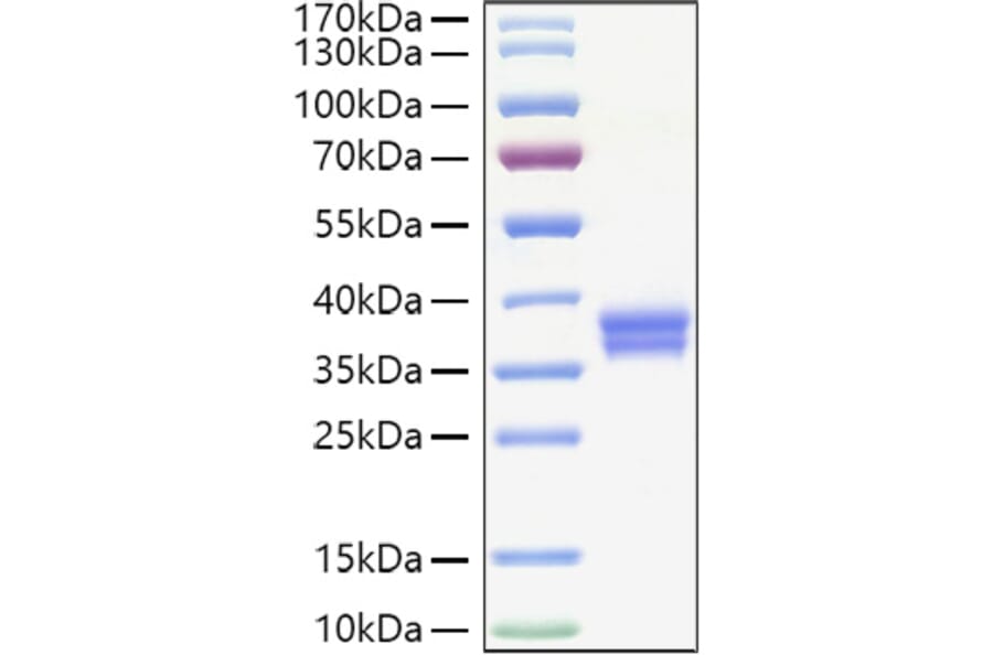 SDS-PAGE - Recombinant Human IGSF11 Protein (C-terminal His Tag) (A330788) - Antibodies.com