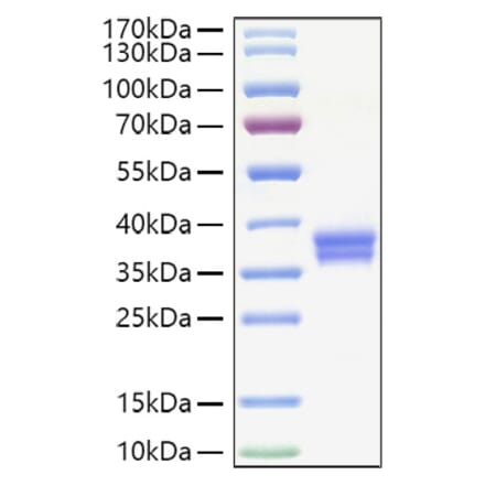 SDS-PAGE - Recombinant Human IGSF11 Protein (C-terminal His Tag) (A330788) - Antibodies.com