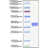 SDS-PAGE - Recombinant Human IGSF11 Protein (C-terminal His Tag) (A330788) - Antibodies.com