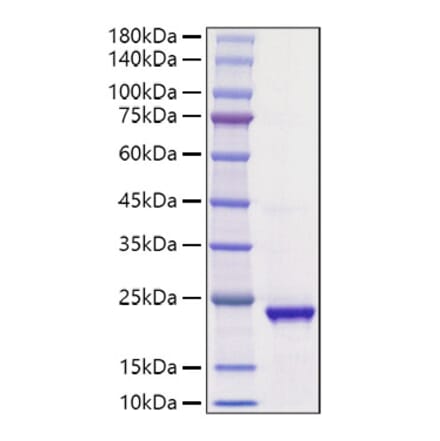 SDS-PAGE - Recombinant Human Ihh Protein (A330789) - Antibodies.com