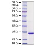 SDS-PAGE - Recombinant Human Ihh Protein (A330789) - Antibodies.com