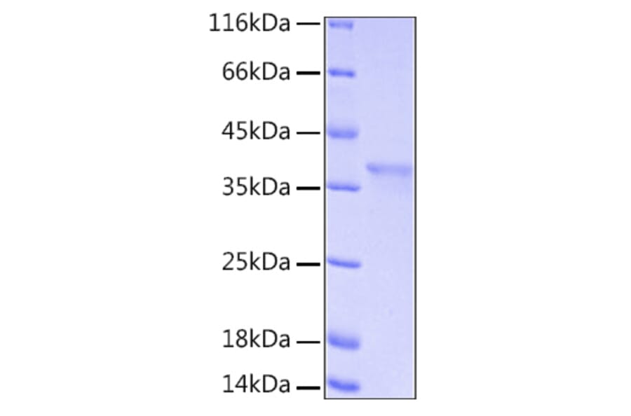 SDS-PAGE - Recombinant Human IkB alpha Protein (A330790) - Antibodies.com