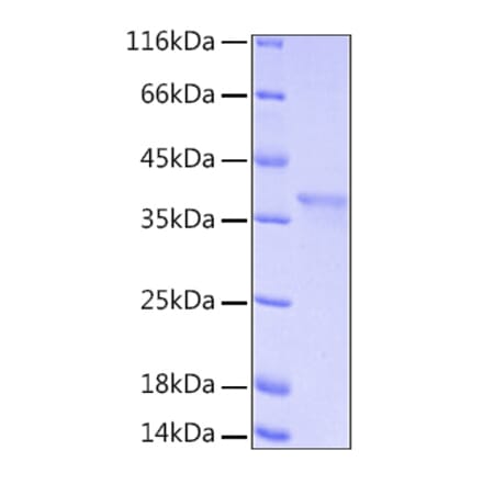 SDS-PAGE - Recombinant Human IkB alpha Protein (A330790) - Antibodies.com