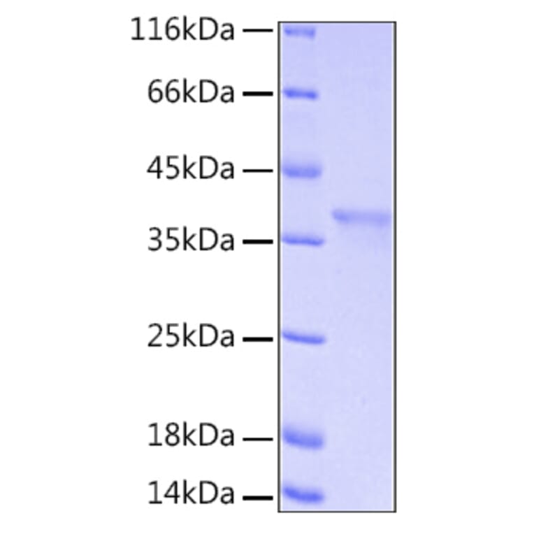 SDS-PAGE - Recombinant Human IkB alpha Protein (A330790) - Antibodies.com