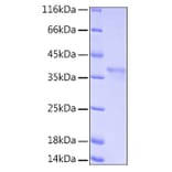 SDS-PAGE - Recombinant Human IkB alpha Protein (A330790) - Antibodies.com