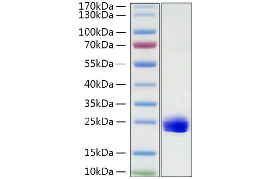 SDS-PAGE - Recombinant Mouse IL-1 alpha Protein (C-terminal His Tag) (A330792) - Antibodies.com