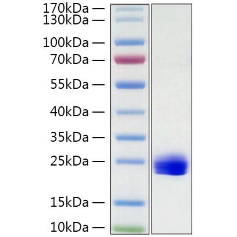 SDS-PAGE - Recombinant Mouse IL-1 alpha Protein (C-terminal His Tag) (A330792) - Antibodies.com