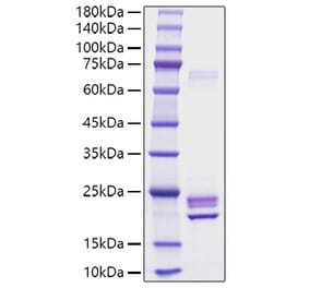 SDS-PAGE - Recombinant Rat IL-1 alpha Protein (C-terminal His Tag) (A330793) - Antibodies.com