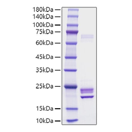 SDS-PAGE - Recombinant Rat IL-1 alpha Protein (C-terminal His Tag) (A330793) - Antibodies.com