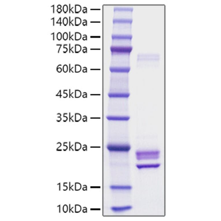 SDS-PAGE - Recombinant Rat IL-1 alpha Protein (C-terminal His Tag) (A330793) - Antibodies.com