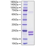 SDS-PAGE - Recombinant Rat IL-1 alpha Protein (C-terminal His Tag) (A330793) - Antibodies.com