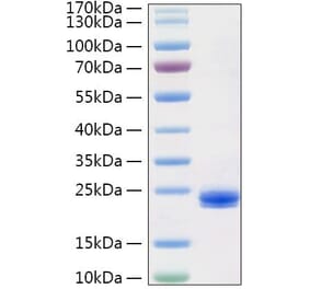 SDS-PAGE - Recombinant Human IL-1 alpha Protein (C-terminal His Tag) (A330794) - Antibodies.com