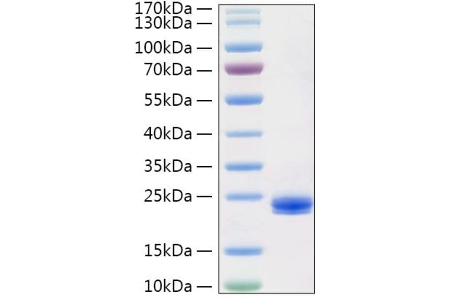 SDS-PAGE - Recombinant Human IL-1 alpha Protein (C-terminal His Tag) (A330794) - Antibodies.com