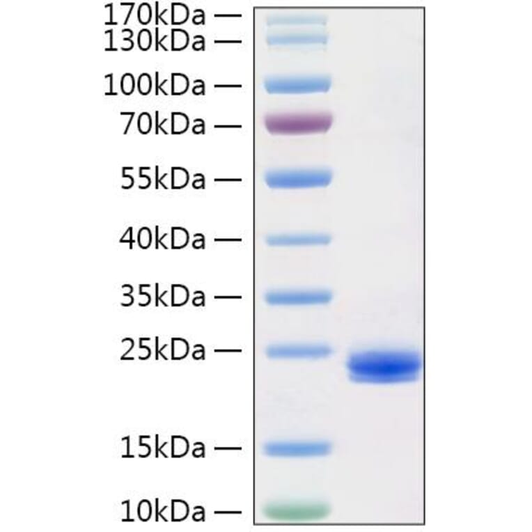 SDS-PAGE - Recombinant Human IL-1 alpha Protein (C-terminal His Tag) (A330794) - Antibodies.com