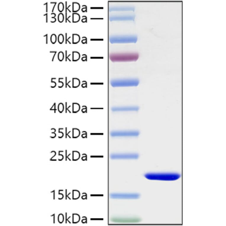 SDS-PAGE - Recombinant Mouse IL-1 beta Protein (C-terminal His Tag) (A330795) - Antibodies.com
