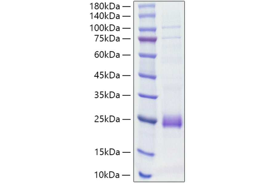 SDS-PAGE - Recombinant Rat IL-1 beta Protein (C-terminal His Tag) (A330796) - Antibodies.com