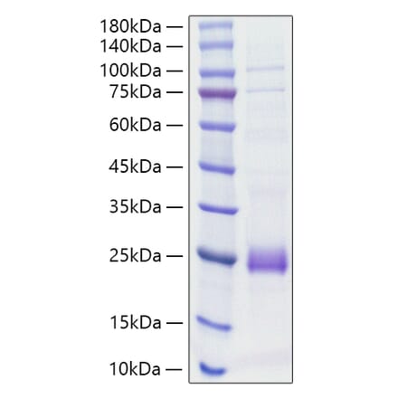 SDS-PAGE - Recombinant Rat IL-1 beta Protein (C-terminal His Tag) (A330796) - Antibodies.com
