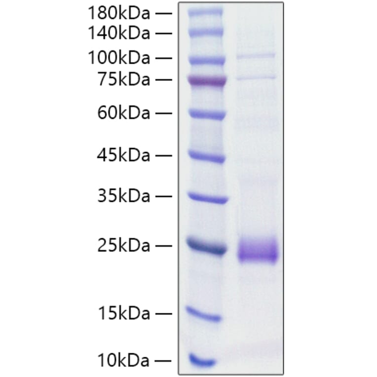 SDS-PAGE - Recombinant Rat IL-1 beta Protein (C-terminal His Tag) (A330796) - Antibodies.com