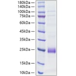 SDS-PAGE - Recombinant Rat IL-1 beta Protein (C-terminal His Tag) (A330796) - Antibodies.com