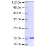 SDS-PAGE - Recombinant Human IL-1 beta Protein (C-terminal His Tag) (A330797) - Antibodies.com