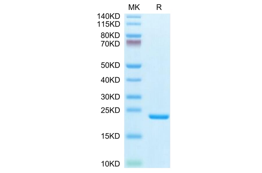 Tris-Bis PAGE - Recombinant Human IL-1 beta Protein (Biotin) (C-terminal His and Avi Tag) (A330798) - Antibodies.com