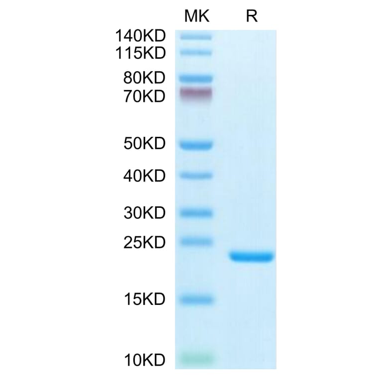Tris-Bis PAGE - Recombinant Human IL-1 beta Protein (Biotin) (C-terminal His and Avi Tag) (A330798) - Antibodies.com