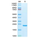 Tris-Bis PAGE - Recombinant Human IL-1 beta Protein (Biotin) (C-terminal His and Avi Tag) (A330798) - Antibodies.com