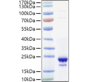 SDS-PAGE - Recombinant Mouse IL-10 Protein (C-terminal His Tag) (A330802) - Antibodies.com