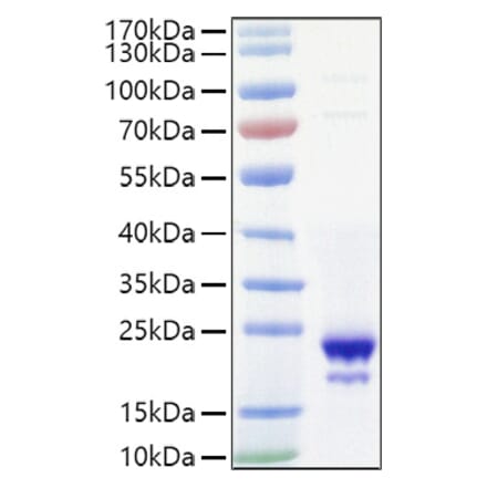 SDS-PAGE - Recombinant Mouse IL-10 Protein (C-terminal His Tag) (A330802) - Antibodies.com