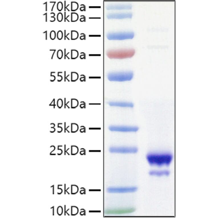 SDS-PAGE - Recombinant Mouse IL-10 Protein (C-terminal His Tag) (A330802) - Antibodies.com