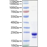 SDS-PAGE - Recombinant Mouse IL-10 Protein (C-terminal His Tag) (A330802) - Antibodies.com