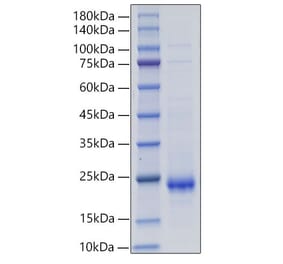 SDS-PAGE - Recombinant Rat IL-10 Protein (C-terminal His Tag) (A330803) - Antibodies.com