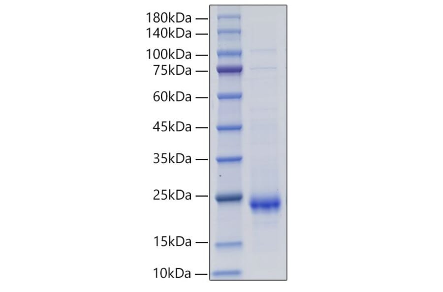 SDS-PAGE - Recombinant Rat IL-10 Protein (C-terminal His Tag) (A330803) - Antibodies.com