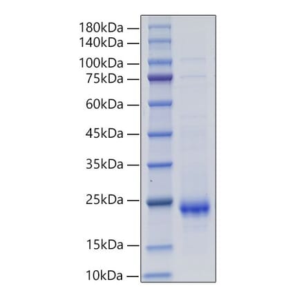 SDS-PAGE - Recombinant Rat IL-10 Protein (C-terminal His Tag) (A330803) - Antibodies.com