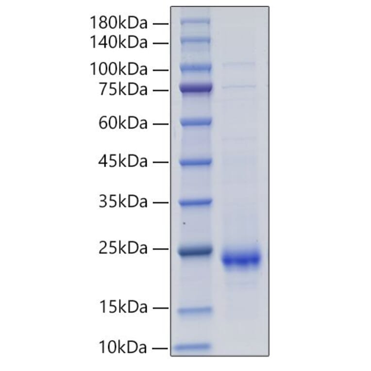 SDS-PAGE - Recombinant Rat IL-10 Protein (C-terminal His Tag) (A330803) - Antibodies.com
