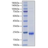 SDS-PAGE - Recombinant Rat IL-10 Protein (C-terminal His Tag) (A330803) - Antibodies.com