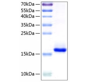 SDS-PAGE - Recombinant Human IL-10 Protein (C-terminal His Tag) (A330804) - Antibodies.com