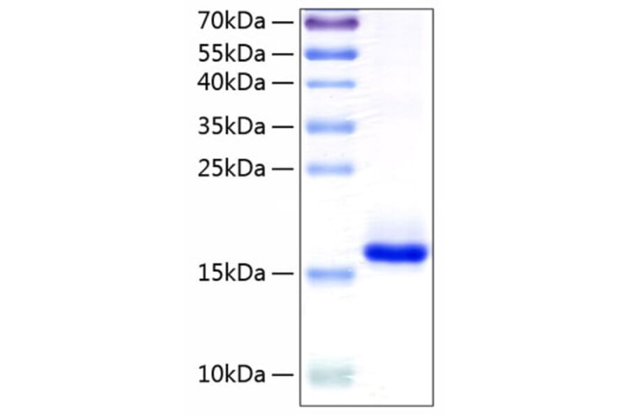 SDS-PAGE - Recombinant Human IL-10 Protein (C-terminal His Tag) (A330804) - Antibodies.com