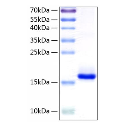 SDS-PAGE - Recombinant Human IL-10 Protein (C-terminal His Tag) (A330804) - Antibodies.com