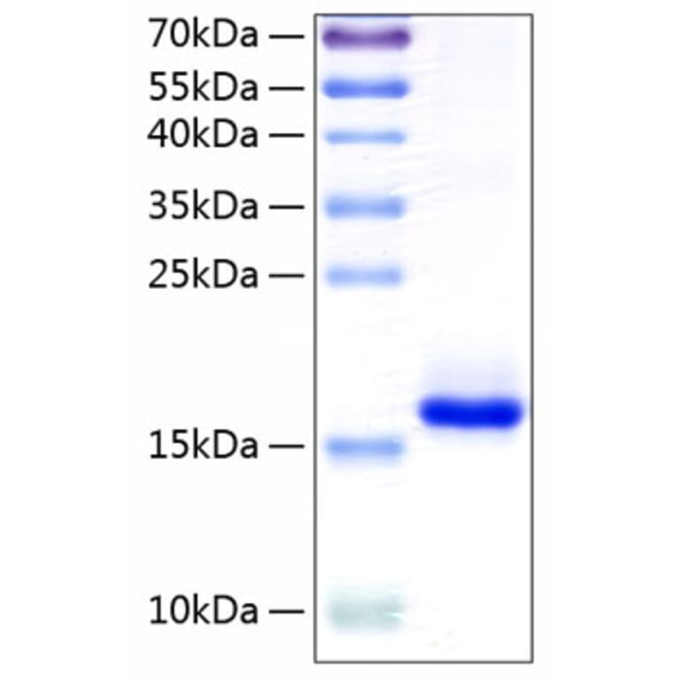 SDS-PAGE - Recombinant Human IL-10 Protein (C-terminal His Tag) (A330804) - Antibodies.com